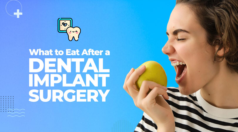 Eat After a Dental Implant Surgery