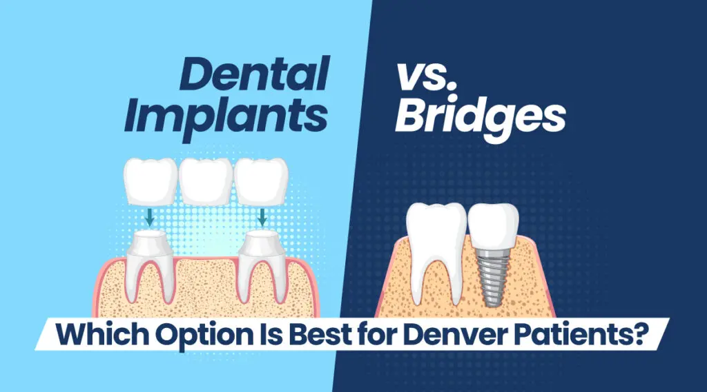 Dental Implants vs Bridges | Altura Periodontics