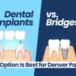 Dental Implants vs Bridges | Altura Periodontics