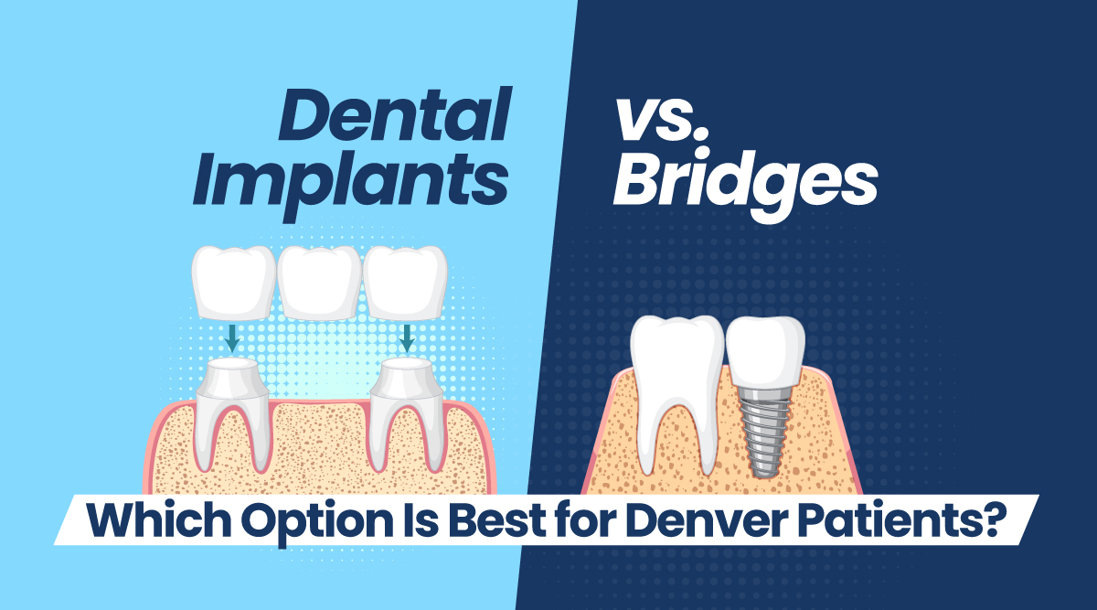 Dental Implants vs. Bridges: Which Option Is Best for Denver Patients?