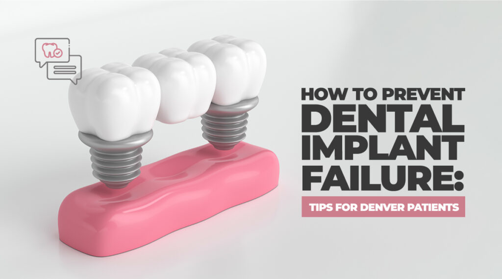 How to prevent dental implant failure - Denver patients | Altura