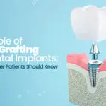 The Role of Bone Grafting in Dental Implants - Denver Dental Implants