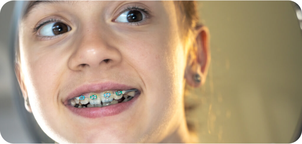 Orthodontic Solutions for Every Age Group